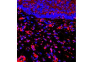 Immunofluorescence of paraffin embedded human esophagus using MYL6 (ABIN7074734) at dilution of 1:650 (400x lens)