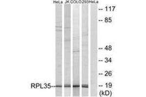 Western blot analysis of extracts from 293/HeLa/COLO/Jurkat cells, using RPL35 Antibody. (RPL35 抗体  (AA 51-100))