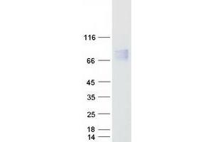 Validation with Western Blot