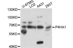 Western blot analysis of extracts of various cells, using P4HA1 antibody. (P4HA1 抗体)