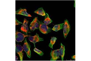 Image no. 2 for anti-Nuclear Factor of kappa Light Polypeptide Gene Enhancer in B-Cells 2 (NFKB2) (AA 864-868) antibody (ABIN197118) (NFKB2 抗体  (AA 864-868))