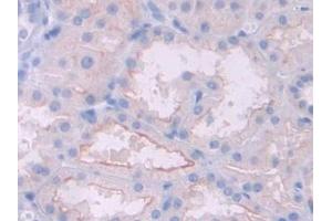 IHC-P analysis of Human Kidney Tissue, with DAB staining. (HFE2 抗体  (AA 234-416))