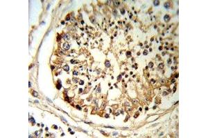 Immunohistochemistry (IHC) image for anti-Plasminogen Activator, Tissue (PLAT) (AA 371-399) antibody (ABIN3032243)