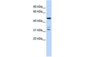 Image no. 1 for anti-HtrA Serine Peptidase 4 (HTRA4) (AA 396-445) antibody (ABIN6741359) (HTRA4 抗体  (AA 396-445))