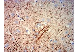 Immunohistochemistry (IHC) image for anti-Neurofilament, Heavy Polypeptide (NEFH) (AA 2-251) antibody (ABIN7193620)