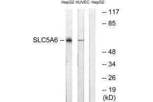Western blot analysis of extracts from HepG2 cells and HUVEC cells, using SLC5A6 antibody. (SLC5A6 抗体)