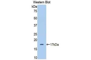Western blot analysis of the recombinant protein. (Complement Factor B 抗体  (AA 477-600))