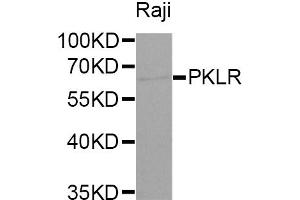 Western blot analysis of extracts of Raji cells, using PKLR antibody (ABIN5970989) at 1/1000 dilution. (PKLR 抗体)