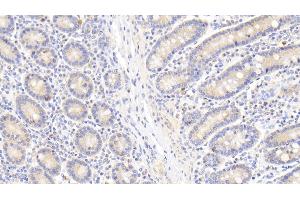 Detection of Hsp60 in Human Small intestine Tissue using Polyclonal Antibody to Heat Shock Protein 60 (Hsp60) (HSPD1 抗体  (AA 1-573))