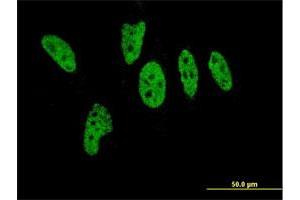 Immunofluorescence of monoclonal antibody to EP300 on HeLa cell. (p300 抗体  (AA 731-830))