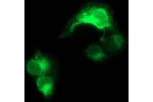 Image no. 3 for anti-CD163 (CD163) antibody (ABIN1497175) (CD163 抗体)