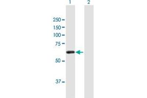 Western Blot analysis of ZSCAN21 expression in transfected 293T cell line by ZSCAN21 MaxPab polyclonal antibody. (ZSCAN21 抗体  (AA 1-473))