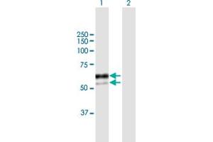Western Blot analysis of SNX8 expression in transfected 293T cell line by SNX8 MaxPab polyclonal antibody. (SNX8 抗体  (AA 1-465))