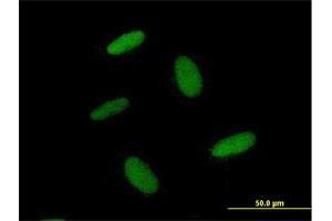 Immunofluorescence of purified MaxPab antibody to ZNF557 on HepG2 cell. (ZNF557 抗体  (AA 1-375))