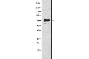 Western blot analysis of RIPK1 using HeLa whole cell lysates (RIPK1 抗体  (Internal Region))