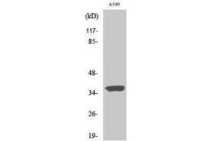 Western Blotting (WB) image for anti-Six Transmembrane Epithelial Antigen of The Prostate 1 (STEAP1) (N-Term) antibody (ABIN3187095) (STEAP1 抗体  (N-Term))
