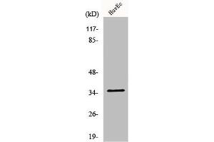 Western Blot analysis of Jurkat cells using Nanog P8 Polyclonal Antibody (NANOGP8 抗体  (Internal Region))