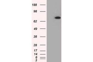 HEK293T cells were transfected with the pCMV6-ENTRY control (Left lane) or pCMV6-ENTRY PDE4A (Right lane) cDNA for 48 hrs and lysed. (PDE4A 抗体)