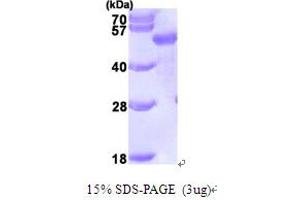 SDS-PAGE (SDS) image for Sequestosome 1 (SQSTM1) (AA 1-356) protein (His tag) (ABIN666979) (SQSTM1 Protein (AA 1-356) (His tag))