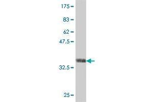 Western Blotting (WB) image for anti-Peptidyl Arginine Deiminase, Type II (PADI2) (AA 1-108) antibody (ABIN564890)