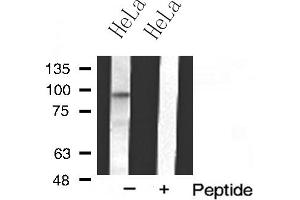 Western blot analysis of MKL1 expression in HeLa cell extract (MKL1 抗体  (N-Term))