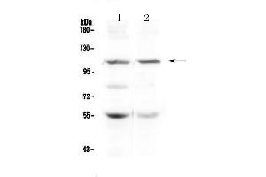Western blot analysis of DPYD using anti-DPYD antibody . (DPYD 抗体  (AA 356-511))