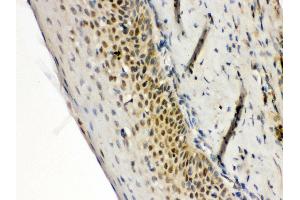 Immunohistochemistry (IHC) image for anti-Recombination Activating Gene 2 (RAG2) (AA 498-527), (C-Term) antibody (ABIN3043918)