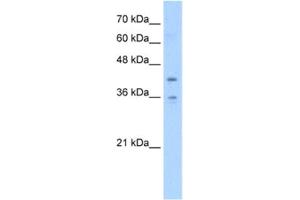 Western Blotting (WB) image for anti-Transmembrane Protein 104 (TMEM104) antibody (ABIN2463056) (TMEM104 抗体)