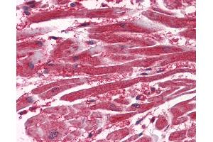 Anti-VEGFR-1 antibody IHC of human heart. (FLT1 抗体  (AA 1251-1338))