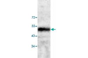 Western blot analysis of human fetal heart tissue lysate with CNN3 polyclonal antibody  at 1:200 dilution. (CNN3 抗体)