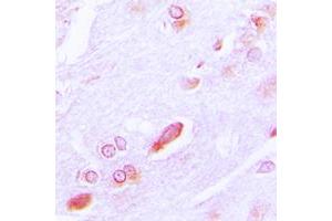 Immunohistochemical analysis of GRP94 staining in human brain formalin fixed paraffin embedded tissue section.