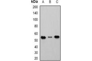 Western blot analysis of Cbl-3 expression in HEK293T (A), Raji (B), mouse kidney (C) whole cell lysates. (CBLC 抗体)