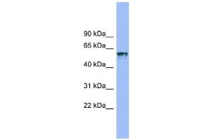 IL18R1 antibody used at 1 ug/ml to detect target protein. (IL18R1 抗体  (N-Term))