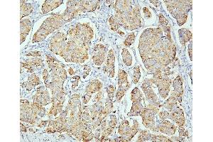 IHC analysis of PPT1 using anti PPT1 antibody (ABIN6719501). (PPT1 抗体  (C-Term))