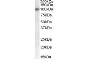 Western Blotting (WB) image for anti-Taste Receptor, Type 1, Member 2 (TAS1R2) (Internal Region) antibody (ABIN2465782) (TAS1R2 抗体  (Internal Region))