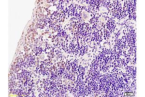 Formalin-fixed and paraffin embedded rat spleen tissue labeled with Anti-Phospho-IRF7 (Ser471/472) Polyclonal Antibody, Unconjugated (ABIN742703) at 1:200 followed by conjugation to the secondary antibody and DAB staining