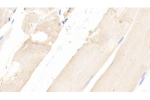 Immunohistochemistry (IHC) image for anti-Mitogen-Activated Protein Kinase 1 (MAPK1) (AA 25-360) antibody (ABIN7445753)