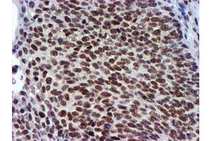 Image no. 5 for anti-Ubiquitin Specific Peptidase 7 (Herpes Virus-Associated) (USP7) antibody (ABIN1498592) (USP7 抗体)