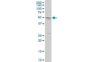 SMC4L1 polyclonal antibody (A01), Lot # 050919JC01. (SMC4 抗体  (AA 646-755))