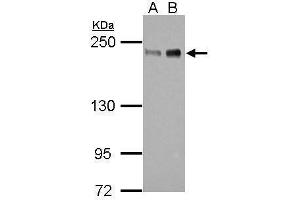WB Image Sample (30 ug of whole cell lysate) A: 293T B: HeLa 5% SDS PAGE antibody diluted at 1:1000 (ZEB1 抗体)