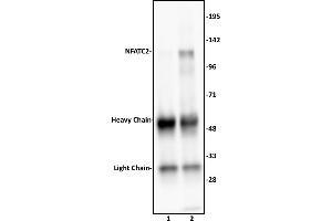 Immunoprecipitation (IP) image for anti-Nuclear Factor of Activated T-Cells, Cytoplasmic, Calcineurin-Dependent 2 (NFAT1) (N-Term) antibody (ABIN6972419)
