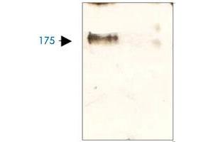 The cell lysate derived from NIH/3T3 was immunoprobed by LRP5 polyclonal antibody  at 1 : 500.