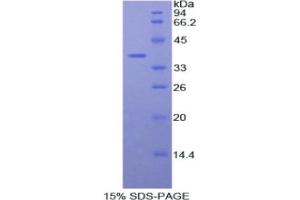 SDS-PAGE analysis of Human Fibulin 4 Protein. (FBLN4 蛋白)
