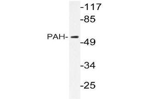 Western blot (WB) analyzes of PAH antibody in extracts from HepG2 cells. (Phenylalanine Hydroxylase 抗体)