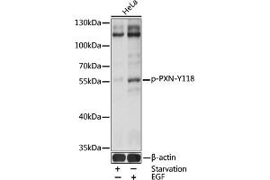 Western blot analysis of extracts of HeLa cells, using Phospho-Paxillin-Y118 antibody (ABIN3019661, ABIN3019662, ABIN3019663 and ABIN1681980) at 1:2000 dilution. (Paxillin 抗体  (pTyr118))