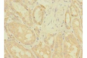 Immunohistochemistry of paraffin-embedded human kidney tissue using ABIN7176445 at dilution of 1:100 (ZNF624 抗体  (AA 127-327))