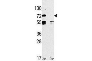 Western blot analysis of anti-TLR2 antibody pre-incubated without and with blocking peptide in CEM lysate (TLR2 抗体  (AA 720-749))