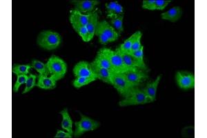Immunofluorescence staining of HepG2 cells with ABIN7163713 at 1:33, counter-stained with DAPI. (Plexin C1 抗体  (AA 81-218))