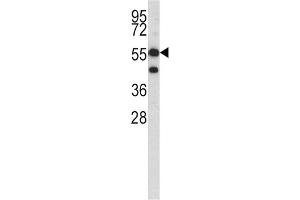 Western Blotting (WB) image for anti-3-Hydroxy-3-Methylglutaryl-CoA Synthase 1 (Soluble) (HMGCS1) antibody (ABIN3002731) (HMGCS1 抗体)