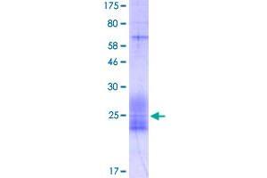 Image no. 1 for Inducible T-Cell Co-Stimulator Ligand (ICOSLG) (AA 18-135) protein (His-DYKDDDDK-Strep II Tag) (ABIN4369890)